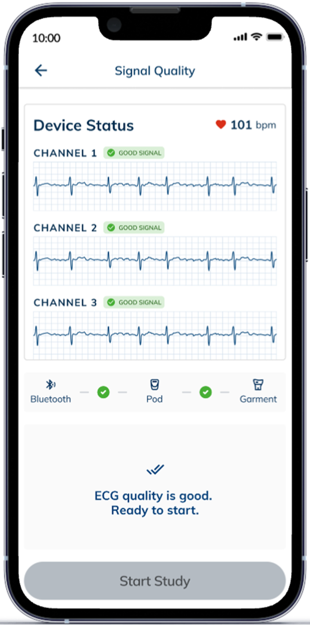 The Signal Quality screen with three ECG channels reading good signal, ready to start