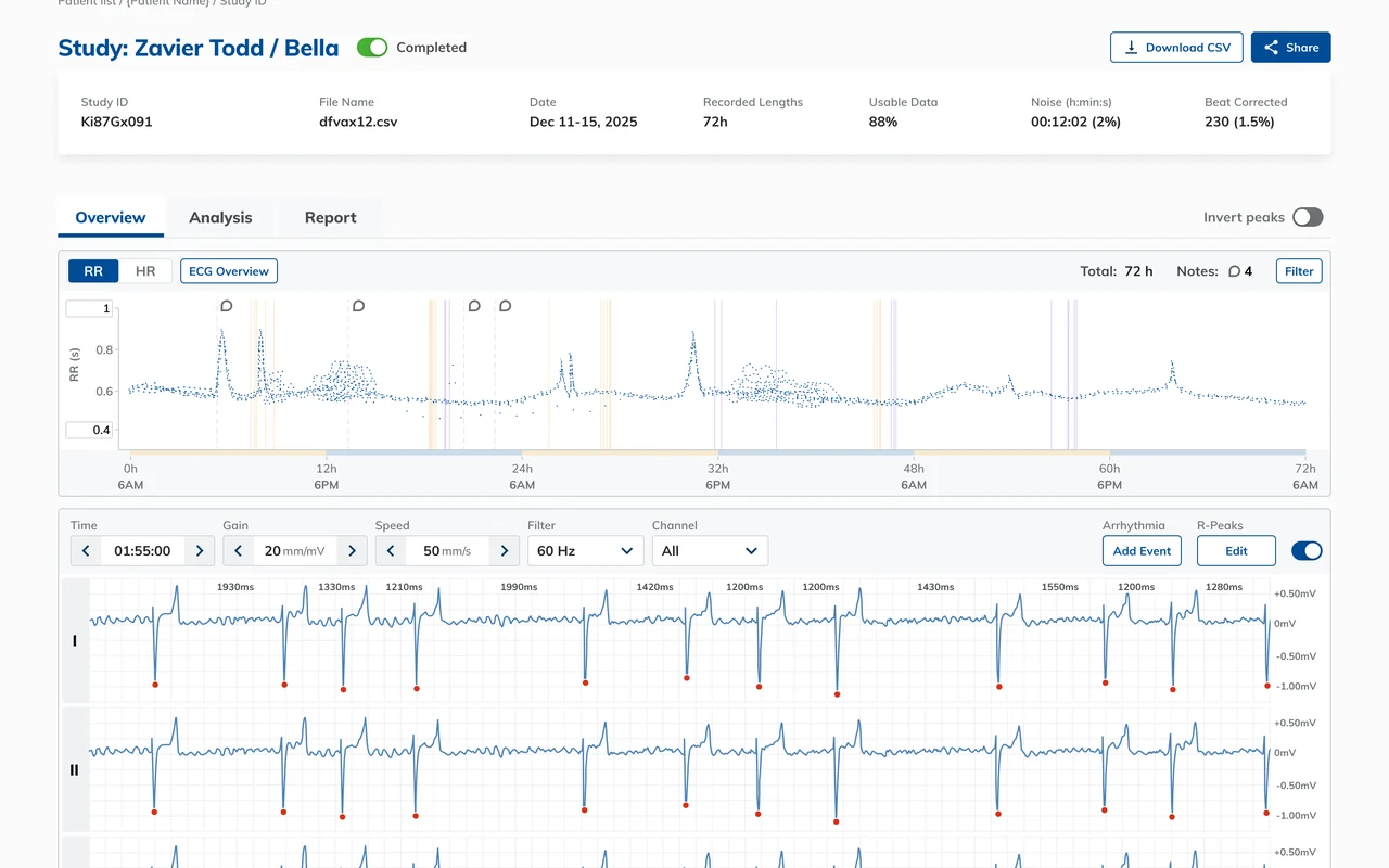 A completed study open in the portal, with three ECG channels and the full 72 hour overview