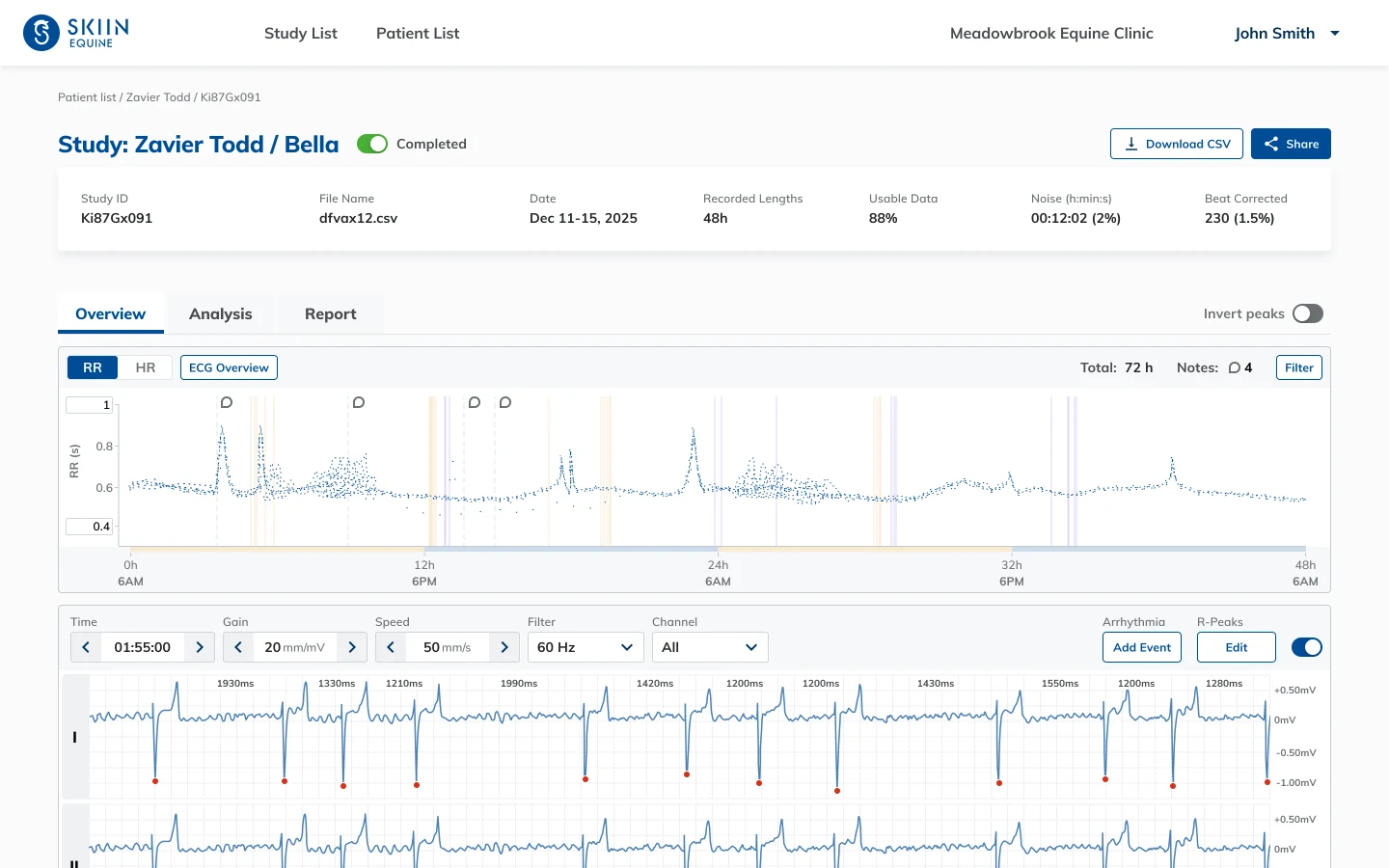 A completed 48 hour study open in the portal, with the heart rate overview above three ECG channels